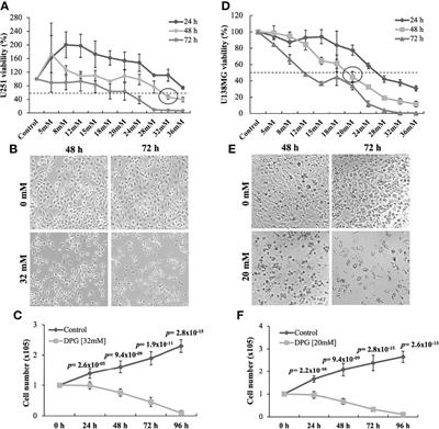 Anti-Migratory Effect of Dipotassium Glycyrrhizinate on Glioblastoma Cell Lines: Microarray Data for the Identification of Key MicroRNA Signatures